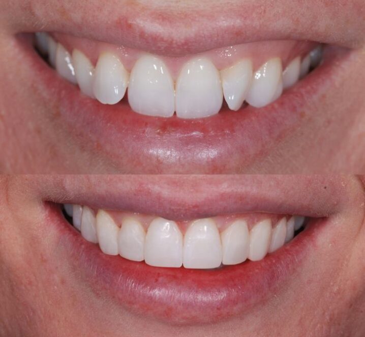 Images by Marton Dental Practice